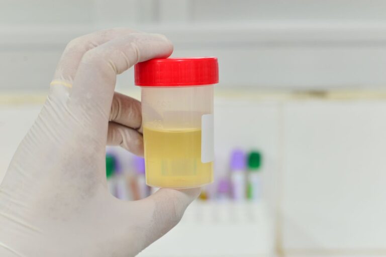 A gloved hand holds a transparent urine container with a red lid, filled with yellow liquid. Blurred test tubes are visible in the background.